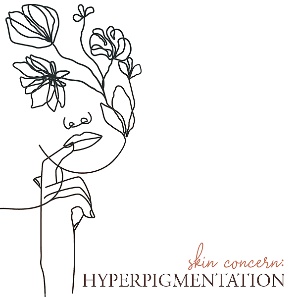 pigment treatment in Lethbridge Alberta