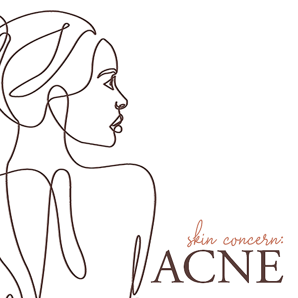 medical acne treatment in Lethbridge